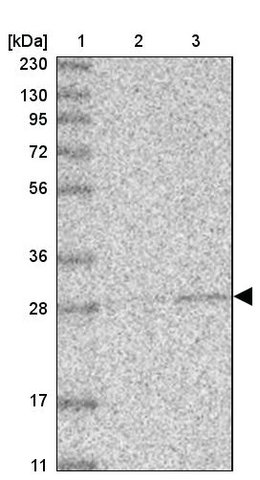 <B>Immunoblotting</B><BR/>Anti-ABHD10: <B>Cat. No. HPA036992</B>: <BR/><B>Lane</B><BR/>1. Marker [kDa] 230, 130, 95, 72, 56, 36, 28, 17, 11<BR/>2. Human cell line RT-4<BR/>3. Human cell line U-251 MG sp