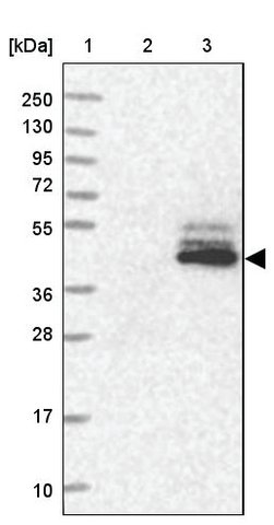 <B>Immunoblotting</B><BR/>Anti-KIAA0825: <B>Cat. No. HPA038030</B>: <BR/><B>Lane</B><BR/>1. Marker [kDa] 250, 130, 95, 72, 55, 36, 28, 17, 10<BR/>2. Human cell line RT-4<BR/>3. Human cell line U-251 MG sp