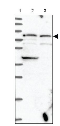 <B>Immunoblotting</B><BR/>Anti-EPB42: <B>Cat. No. HPA040261</B>: <BR/><B>Lane</B><BR/>1. Marker [kDa] 250, 130, 95, 72, 55, 36, 28, 17, 10<BR/>2. Human cell line RT-4<BR/>3. Human cell line U-251 MG sp