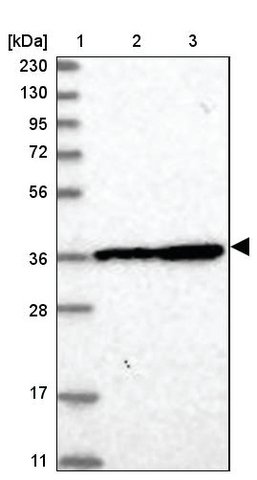 <B>Immunoblotting</B><BR/>Anti-DNAJB14: <B>Cat. No. HPA036016</B>: <BR/><B>Lane</B><BR/>1. Marker [kDa] 230, 130, 95, 72, 56, 36, 28, 17, 11<BR/>2. Human cell line RT-4<BR/>3. Human cell line U-251 MG sp
