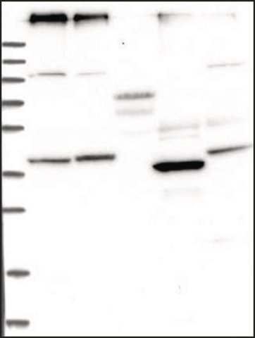 <B>Immunoblotting</B><BR/>Anti-ANO6: <B>Cat. No. HPA038958</B>: Lane 1: Marker [kDa] 250, 130, 95, 72, 55, 36, 28, 17, 10<BR/>Lane 2: RT-4<BR/>Lane 3: U-251 MG<BR/>Lane 4: Human Plasma<BR/>Lane 5: Liver<BR/>Lane 6: Tonsil