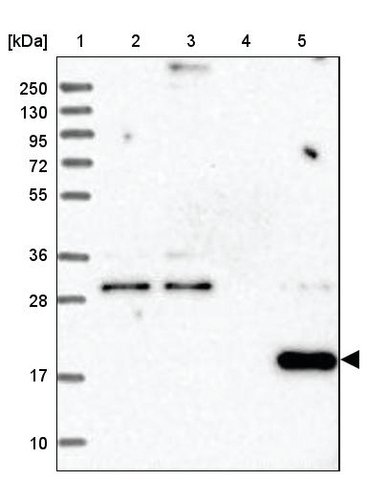 <B>Immunoblotting</B><BR/>Anti-RWDD4: <B>Cat. No. HPA036502</B>: <BR/><B>Lane</B><BR/>1. Marker [kDa] 250, 130, 95, 72, 55, 36, 28, 17, 10<BR/>2. Human cell line RT-4<BR/>3. Human cell line U-251 MG sp<BR/>4. Human plasma (IgG/HSA depleted)<BR/>5. Human liver tissue