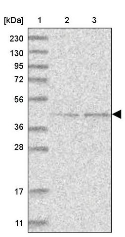 <B>Immunoblotting</B><BR/>Anti-GTDC1: <B>Cat. No. HPA036694</B>: <BR/><B>Lane</B><BR/>1. Marker [kDa] 230, 130, 95, 72, 56, 36, 28, 17, 11<BR/>2. Human cell line RT-4<BR/>3. Human cell line U-251 MG sp