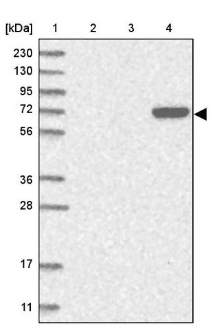 <B>Immunoblotting</B><BR/>Anti-FAM217A: <B>Cat. No. HPA035455</B>: <BR/><B>Lane</B><BR/>1. Marker [kDa] 230, 130, 95, 72, 56, 36, 28, 17, 11<BR/>2. Human cell line RT-4<BR/>3. Human cell line U-251 MG sp<BR/>4. Human plasma (IgG/HSA depleted)