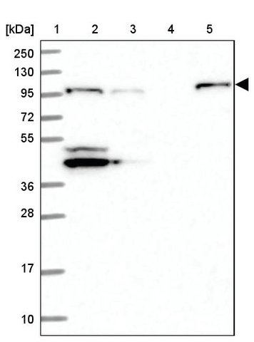 <B>Immunoblotting</B><BR/>Anti-NLRX1: <B>Cat. No. HPA038630</B>: <BR/><B>Lane</B><BR/>1. Marker [kDa] 250, 130, 95, 72, 55, 36, 28, 17, 10<BR/>2. Human cell line RT-4<BR/>3. Human cell line U-251 MG sp<BR/>4. Human plasma (IgG/HSA depleted)<BR/>5. Human liver tissue