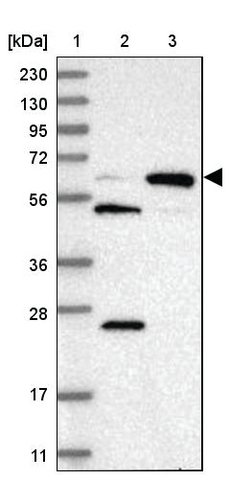 <B>Immunoblotting</B><BR/>Anti-PYROXD2: <B>Cat. No. HPA037566</B>: <BR/><B>Lane</B><BR/>1. Marker [kDa] 230, 130, 95, 72, 56, 36, 28, 17, 11<BR/>2. Human cell line RT-4<BR/>3. Human cell line U-251 MG sp