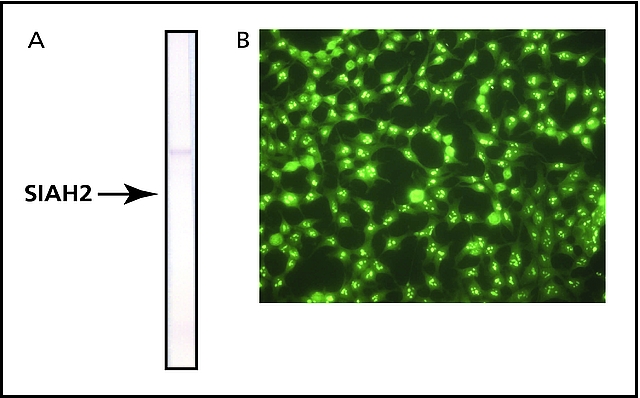 <B>A. Immunoblot</B><BR/>Mouse brain extract was separated on SDS-PAGE and probed with Monoclonal Anti-SIAH2 (<B>Cat No. S7945</B>, 1 μg/mL). The antibody was developed with Rabbit Anti-Mouse Fab, Biotin conjugate and ExtrAvidin, Alkaline Phosphatase conjugate (<B>Cat. No. E2636</B>).<BR/><B>B. Immunocytochemistry </B><BR/>HEK-293T cells were labeled with Monoclonal Anti-SIAH2 (<B>Cat. No. S7945</B>, 20 μg/mL) followed by Goat Anti-Mouse Fab-FITC conjugate (<B>Cat. No. F5262</B>).