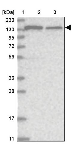 <B>Immunoblotting</B><BR/>Anti-MSH3: <B>Cat. No. HPA036081</B>: <BR/><B>Lane</B><BR/>1. Marker [kDa] 230, 130, 95, 72, 56, 36, 28, 17, 11<BR/>2. Human cell line RT-4<BR/>3. Human cell line U-251 MG sp