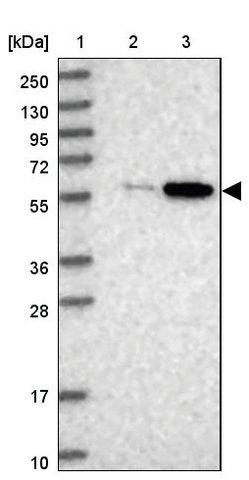 <B>Immunoblotting</B><BR/>Anti-BUD13: <B>Cat. No. HPA038341</B>: <BR/><B>Lane</B><BR/>1. Marker [kDa] 250, 130, 95, 72, 55, 36, 28, 17, 10<BR/>2. Human cell line RT-4<BR/>3. Human cell line U-251 MG sp