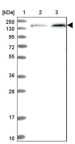 <B>Immunoblotting</B><BR/>Anti-NUP155: <B>Cat. No. HPA037774</B>: <BR/><B>Lane</B><BR/>1. Marker [kDa] 250, 130, 95, 72, 55, 36, 28, 17, 10<BR/>2. Human cell line RT-4<BR/>3. Human cell line U-251 MG sp