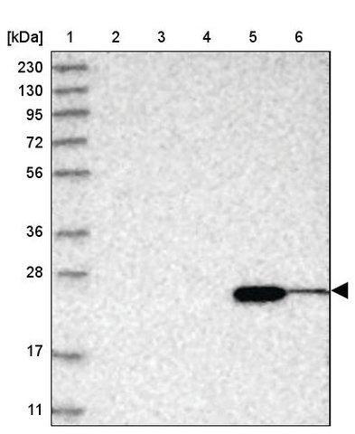 <B>Immunoblotting</B><BR/>Anti-ABHD14B: <B>Cat. No. HPA036444</B>: <BR/><B>Lane</B><BR/>1. Marker [kDa] 230, 130, 95, 72, 56, 36, 28, 17, 11<BR/>2. Human cell line RT-4<BR/>3. Human cell line U-251 MG sp<BR/>4. Human plasma (IgG/HSA depleted)<BR/>5. Human liver tissue<BR/>6. Human tonsil tissue