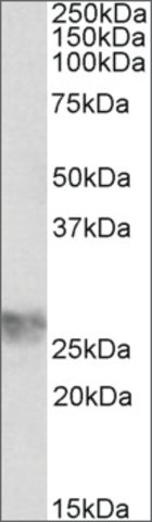 <B>Immunoblotting</B><BR/>Anti-ICAM4<B>Cat. No. SAB2502155</B>: Immunoblotting (1 μg/mL) staining of Human Umbillical Cord lysate (35 μg protein in RIPA buffer). Primary incubation was 1 hour. Detected by chemiluminescence.