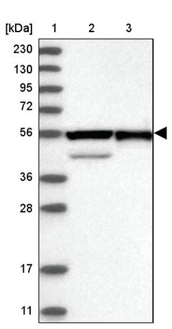 <B>Immunoblotting</B><BR/>Anti-RBMS3: <B>Cat. No. HPA034719</B>: <BR/><B>Lane</B><BR/>1. Marker [kDa] 230, 130, 95, 72, 56, 36, 28, 17, 11<BR/>2. Human cell line RT-4<BR/>3. Human cell line U-251 MG sp