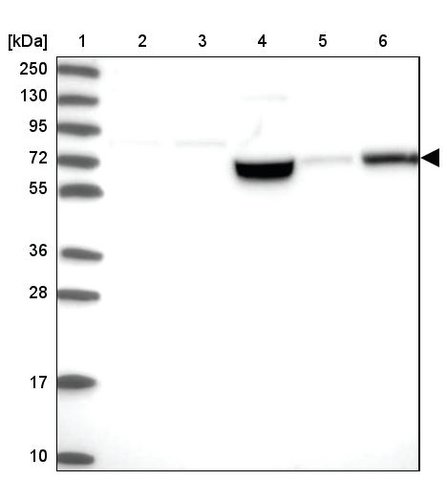 <B>Immunoblotting</B><BR/>Anti-FAM111B: <B>Cat. No. HPA038637</B>: <BR/><B>Lane</B><BR/>1. Marker [kDa] 250, 130, 95, 72, 55, 36, 28, 17, 10<BR/>2. Human cell line RT-4<BR/>3. Human cell line U-251 MG sp<BR/>4. Human plasma (IgG/HSA depleted)<BR/>5. Human liver tissue<BR/>6. Human tonsil tissue