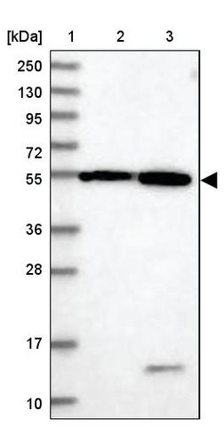 <B>Immunoblotting</B><BR/>Anti-DEPDC4: <B>Cat. No. HPA039323</B>: <BR/><B>Lane</B><BR/>1. Marker [kDa] 250, 130, 95, 72, 55, 36, 28, 17, 10<BR/>2. Human cell line RT-4<BR/>3. Human cell line U-251 MG sp