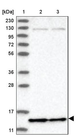 <B>Immunoblotting</B><BR/>Anti-AC008073.5: <B>Cat. No. HPA034829</B>: <BR/><B>Lane</B><BR/>1. Marker [kDa] 230, 130, 95, 72, 56, 36, 28, 17, 11<BR/>2. Human cell line RT-4<BR/>3. Human cell line U-251 MG sp