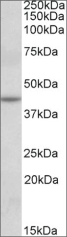 <B>Immunoblotting</B><BR/>Anti-Nat8l<B>Cat. No. SAB2502126</B>: Immunoblotting (0.1 μg/mL) staining of fetal Mouse Brain lysate (35 μg protein in RIPA buffer). Primary incubation was 1 hour. Detected by chemiluminescence.