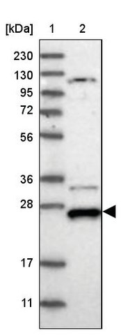 <B>Immunoblotting</B><BR/>Anti-DCUN1D4: <B>Cat. No. HPA036484</B>: <BR/><B>Lane</B><BR/>1. Marker [kDa] 230, 130, 95, 72, 56, 36, 28, 17, 11<BR/>2. Human cell line RT-4