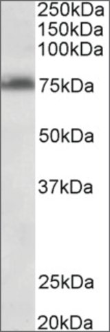 <B>Immunoblotting</B><BR/>Anti-TSPYL2<B>Cat. No. SAB2502020</B>: Immunoblotting (0.3 μg/mL) staining of Jurkat lysate (35 μg protein in RIPA buffer). Primary incubation was 1 hour. Detected by chemiluminescence.
