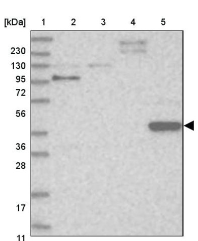 <B>Immunoblotting</B><BR/>Anti-PPP1R36: <B>Cat. No. HPA036801</B>: <BR/><B>Lane</B><BR/>1. Marker [kDa] 230, 130, 95, 72, 56, 36, 28, 17, 11<BR/>2. Human cell line RT-4<BR/>3. Human cell line U-251 MG sp<BR/>4. Human plasma (IgG/HSA depleted)<BR/>5. Human liver tissue