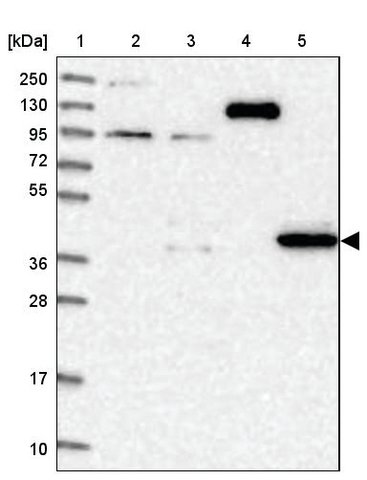 <B>Immunoblotting</B><BR/>Anti-PDSS1: <B>Cat. No. HPA038032</B>: <BR/><B>Lane</B><BR/>1. Marker [kDa] 250, 130, 95, 72, 55, 36, 28, 17, 10<BR/>2. Human cell line RT-4<BR/>3. Human cell line U-251 MG sp<BR/>4. Human plasma (IgG/HSA depleted)<BR/>5. Human liver tissue