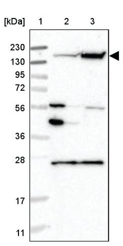 <B>Immunoblotting</B><BR/>Anti-NCAPD2: <B>Cat. No. HPA037363</B>: <BR/><B>Lane</B><BR/>1. Marker [kDa] 230, 130, 95, 72, 56, 36, 28, 17, 11<BR/>2. Human cell line RT-4<BR/>3. Human cell line U-251 MG sp