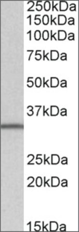 <B>Immunoblotting</B><BR/>Anti-SLC9A3R2<B>Cat. No. SAB2501927</B>: Immunoblotting (1 μg/mL) staining of Daudi lysate (35 μg protein in RIPA buffer). Primary incubation was 1 hour. Detected by chemiluminescence.