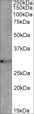 <B>Immunoblotting</B><BR/>Anti-TSPAN14 (C-terminal) <B>Cat. No. SAB2502125</B>: Immunoblotting (2 μg/mL) staining of Mouse Brain lysate (35 μg protein in RIPA buffer). Primary incubation was 1 hour. Detected by chemiluminescence.