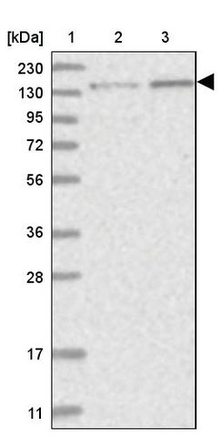 <B>Immunoblotting</B><BR/>Anti-PPP2R3A: <B>Cat. No. HPA035829</B>: <BR/><B>Lane</B><BR/>1. Marker [kDa] 230, 130, 95, 72, 56, 36, 28, 17, 11<BR/>2. Human cell line RT-4<BR/>3. Human cell line U-251 MG sp