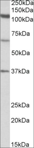 <B>Immunoblotting</B><BR/>Anti-CP110 (N-terminal) <B>Cat. No. SAB2502023</B>: Immunoblotting (1 μg/mL) staining of Human Testis lysate (35 μg protein in RIPA buffer). Primary incubation was 1 hour. Detected by chemiluminescence.