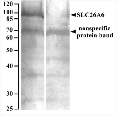<B>Immunoblotting</B><BR/>Anti-SLC26A6<B>Cat. No. SAB2501959</B>: Immunoblotting (10 μg/mL) staining of Human renal cortical brush-border membrane lysate (90 μg protein denatured at 37 °C for 30 min) with (B) and without (A) blocking with the immunizing peptide. Primary incubation was overnight at 4 °C. Detected by NBT/BCIP.