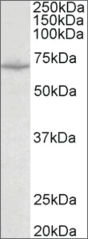 <B>Immunoblotting</B><BR/>Anti-SLC6A8<B>Cat. No. SAB2501990</B>: Immunoblotting (0.1 μg/mL) staining of Mouse Heart lysate (35 μg protein in RIPA buffer). Primary incubation was 1 hour. Detected by chemiluminescence.