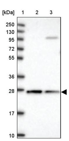 <B>Immunoblotting</B><BR/>Anti-CYB5R2: <B>Cat. No. HPA038962</B>: <BR/><B>Lane</B><BR/>1. Marker [kDa] 250, 130, 95, 72, 55, 36, 28, 17, 10<BR/>2. Human cell line RT-4<BR/>3. Human cell line U-251 MG sp