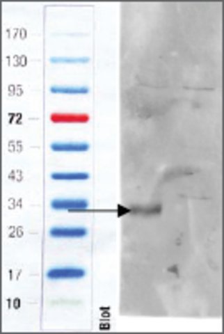 <B>Immunoblotting</B><BR/>Anti-Cd97 (C-terminal) <B>Cat. No. SAB2502147</B>: Immunoblotting (1 μg/mL) staining of Mouse Colon (wt, left lane; knock-out, right lane) lysate (35 μg protein in RIPA buffer). Primary incubation was 1 hour. Detected by infrared fluorescence (Odyssey).