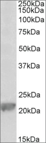 <B>Immunoblotting</B><BR/>Anti-Gpx1<B>Cat. No. SAB2502103</B>: Immunoblotting (0.1g/mL) staining of Rat Liver lysate (35 μg protein in RIPA buffer). Primary incubation was 1 hour. Detected by chemiluminescence.