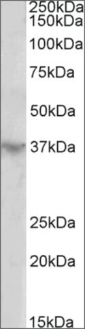 <B>Immunoblotting</B><BR/>Anti-HOXD12<B>Cat. No. SAB2502156</B>: Immunoblotting (2 μg/mL) staining of Human Heart lysate (35 μg protein in RIPA buffer). Primary incubation was 1 hour. Detected by chemiluminescence.