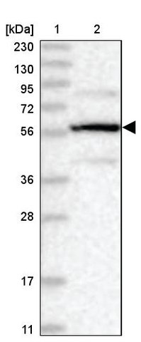 <B>Immunoblotting</B><BR/>Anti-PPP2R5B: <B>Cat. No. HPA036607</B>: <BR/><B>Lane</B><BR/>1. Marker [kDa] 230, 130, 95, 72, 56, 36, 28, 17, 11<BR/>2. Human cell line RT-4