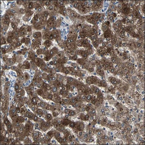 <B>Immunohistochemistry</B><BR/>Anti-ACACB: <B>Cat. No. HPA006554</B>: Immunoperoxidase staining of formalin-fixed, paraffin-embedded human liver shows strong cytoplasmic positivity in hepatocytes.