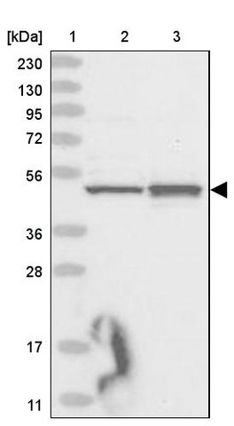 <B>Immunoblotting</B><BR/>Anti-MICU1: <B>Cat. No. HPA037480</B>: <BR/><B>Lane</B><BR/>1. Marker [kDa] 230, 130, 95, 72, 56, 36, 28, 17, 11<BR/>2. Human cell line RT-4<BR/>3. Human cell line U-251 MG sp