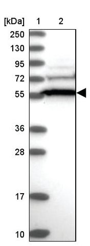 <B>Immunoblotting</B><BR/>Anti-CCDC91: <B>Cat. No. HPA038169</B>: <BR/><B>Lane</B><BR/>1. Marker [kDa] 250, 130, 95, 72, 55, 36, 28, 17, 10<BR/>2. Human cell line RT-4