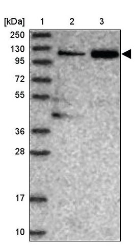 <B>Immunoblotting</B><BR/>Anti-TGFBRAP1: <B>Cat. No. HPA038397</B>: <BR/><B>Lane</B><BR/>1. Marker [kDa] 250, 130, 95, 72, 55, 36, 28, 17, 10<BR/>2. Human cell line RT-4<BR/>3. Human cell line U-251 MG sp