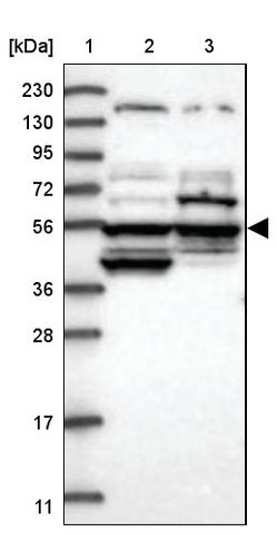 <B>Immunoblotting</B><BR/>Anti-POC5: <B>Cat. No. HPA037510</B>: <BR/><B>Lane</B><BR/>1. Marker [kDa] 230, 130, 95, 72, 56, 36, 28, 17, 11<BR/>2. Human cell line RT-4<BR/>3. Human cell line U-251 MG sp