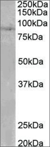 <B>Immunoblotting</B><BR/>Anti-SETDB2 (C or N-terminal) <B>Cat. No. SAB2501995</B>: Immunoblotting (0.1 μg/mL) staining of Human Heart lysate (35 μg protein in RIPA buffer). Primary incubation was 1 hour. Detected by chemiluminescence.