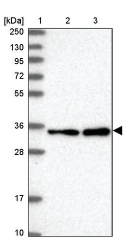 <B>Immunoblotting</B><BR/>Anti-RPRD1A: <B>Cat. No. HPA040602</B>: <BR/><B>Lane</B><BR/>1. Marker [kDa] 250, 130, 95, 72, 55, 36, 28, 17, 10<BR/>2. Human cell line RT-4<BR/>3. Human cell line U-251 MG sp