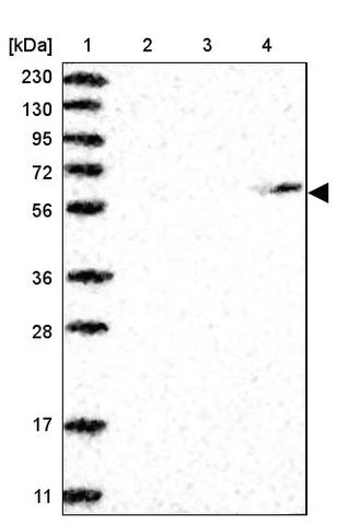 <B>Immunoblotting</B><BR/>Anti-MDH1B: <B>Cat. No. HPA034741</B>: <BR/><B>Lane</B><BR/>1. Marker [kDa] 230, 130, 95, 72, 56, 36, 28, 17, 11<BR/>2. Human cell line RT-4<BR/>3. Human cell line U-251 MG sp<BR/>4. Human plasma (IgG/HSA depleted)