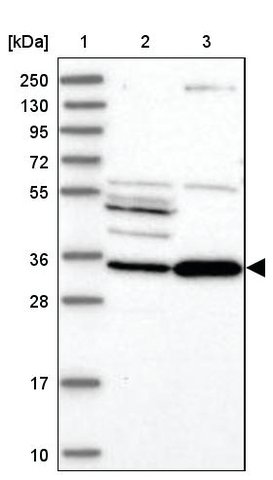 <B>Immunoblotting</B><BR/>Anti-SDR9C7: <B>Cat. No. HPA039059</B>: <BR/><B>Lane</B><BR/>1. Marker [kDa] 250, 130, 95, 72, 55, 36, 28, 17, 10<BR/>2. Human cell line RT-4<BR/>3. Human cell line U-251 MG sp