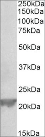 <B>Immunoblotting</B><BR/>Anti-Gpx1<B>Cat. No. SAB2502102</B>: Immunoblotting (0.3 μg/mL) staining of Rat Liver lysate (35 μg protein in RIPA buffer). Primary incubation was 1 hour. Detected by chemiluminescence.