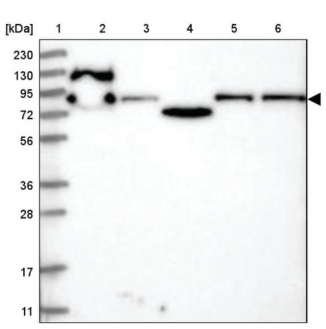 <B>Immunoblotting</B><BR/>Anti-PPP1R21: <B>Cat. No. HPA036791</B>: <BR/><B>Lane</B><BR/>1. Marker [kDa] 230, 130, 95, 72, 56, 36, 28, 17, 11<BR/>2. Human cell line RT-4<BR/>3. Human cell line U-251 MG sp<BR/>4. Human plasma (IgG/HSA depleted)<BR/>5. Human liver tissue<BR/>6. Human tonsil tissue