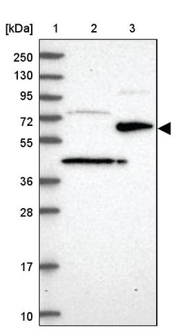 <B>Immunoblotting</B><BR/>Anti-ST7: <B>Cat. No. HPA038325</B>: <BR/><B>Lane</B><BR/>1. Marker [kDa] 250, 130, 95, 72, 55, 36, 28, 17, 10<BR/>2. Human cell line RT-4<BR/>3. Human cell line U-251 MG sp