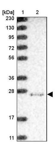 <B>Immunoblotting</B><BR/>Anti-IRAK1BP1: <B>Cat. No. HPA035742</B>: <BR/><B>Lane</B><BR/>1. Marker [kDa] 230, 130, 95, 72, 56, 36, 28, 17, 11<BR/>2. Human cell line RT-4